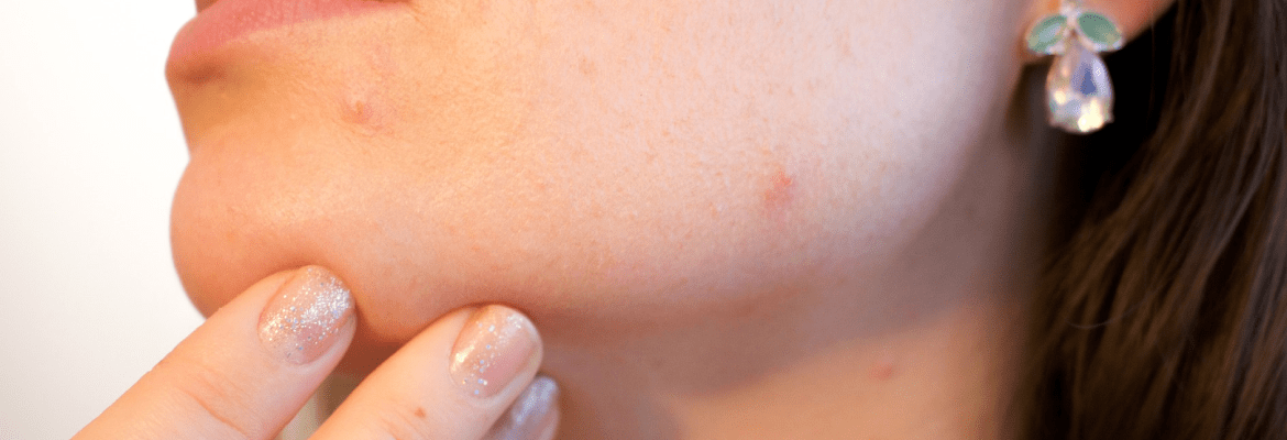 Aura Skin-N-Beauty