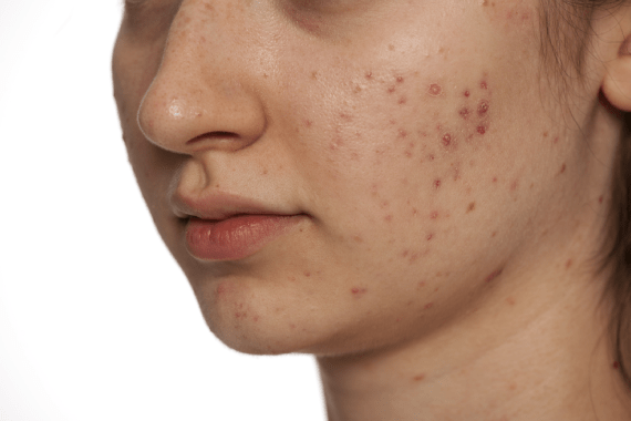Aura Skin-N-Beauty